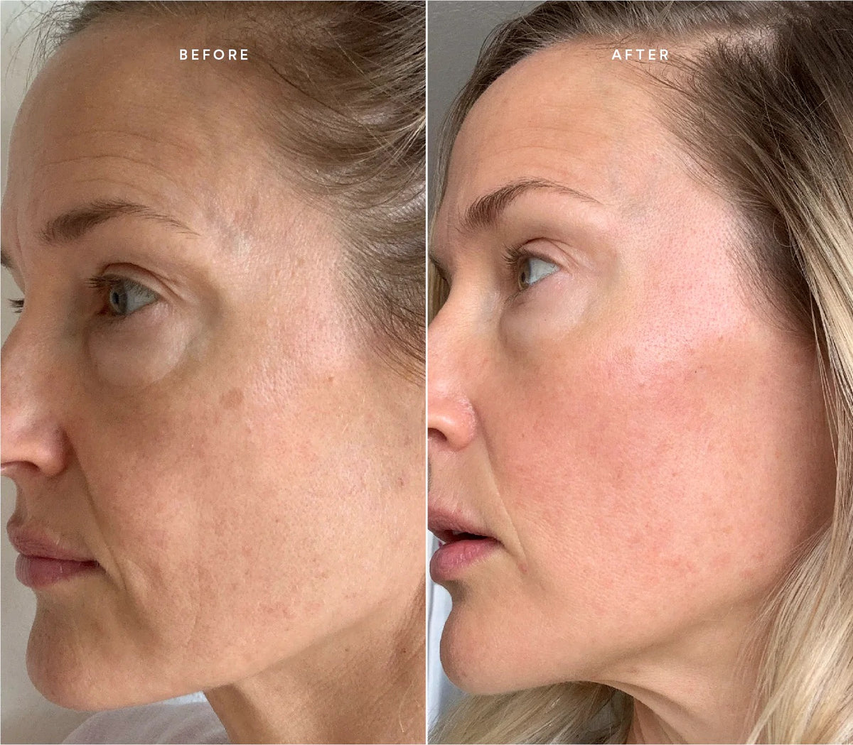 Before & After