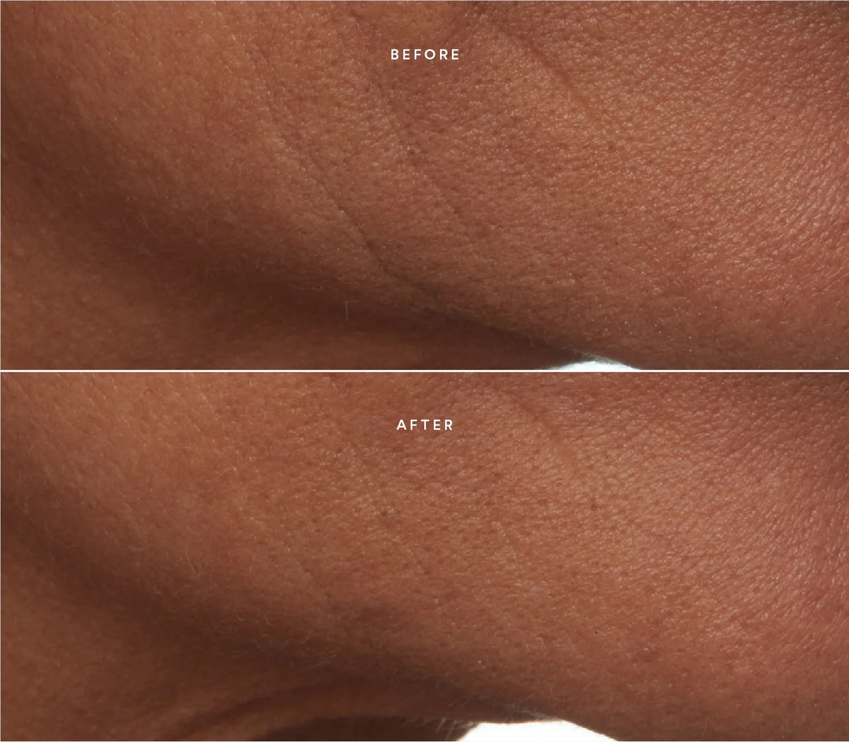 Before & After