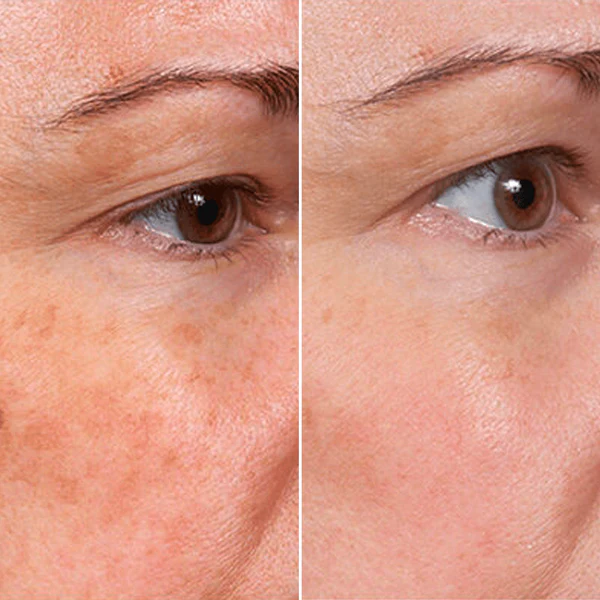 Before & After