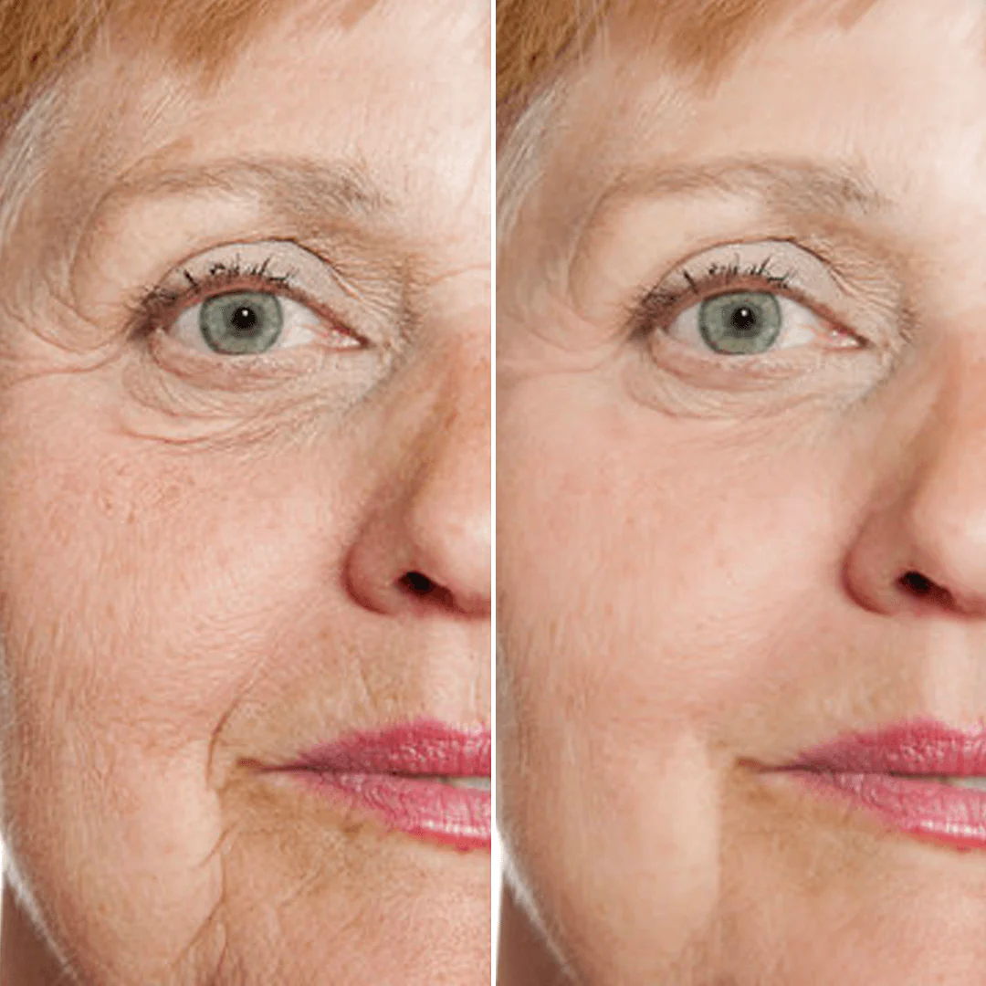 Before & After