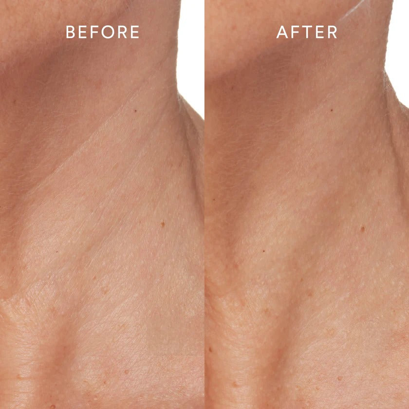 Before & After