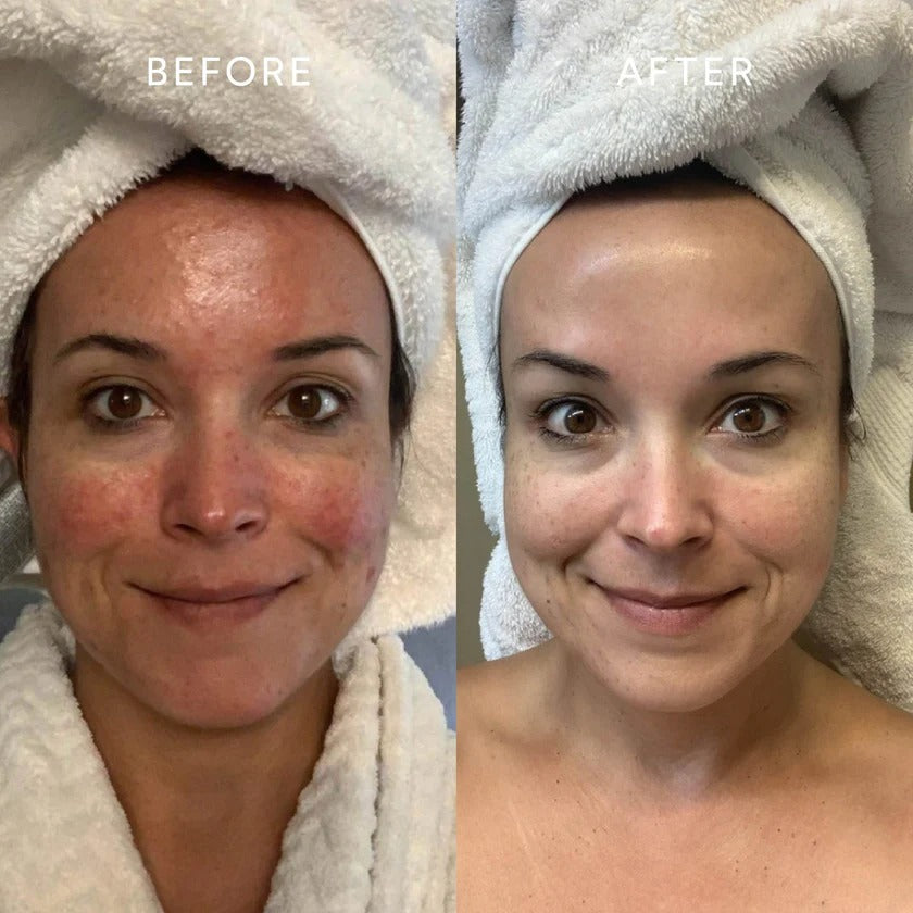 Before & After