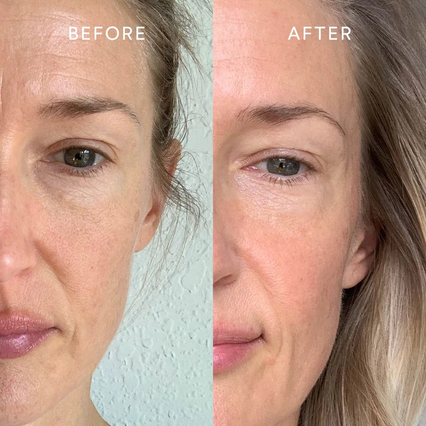 Before & After